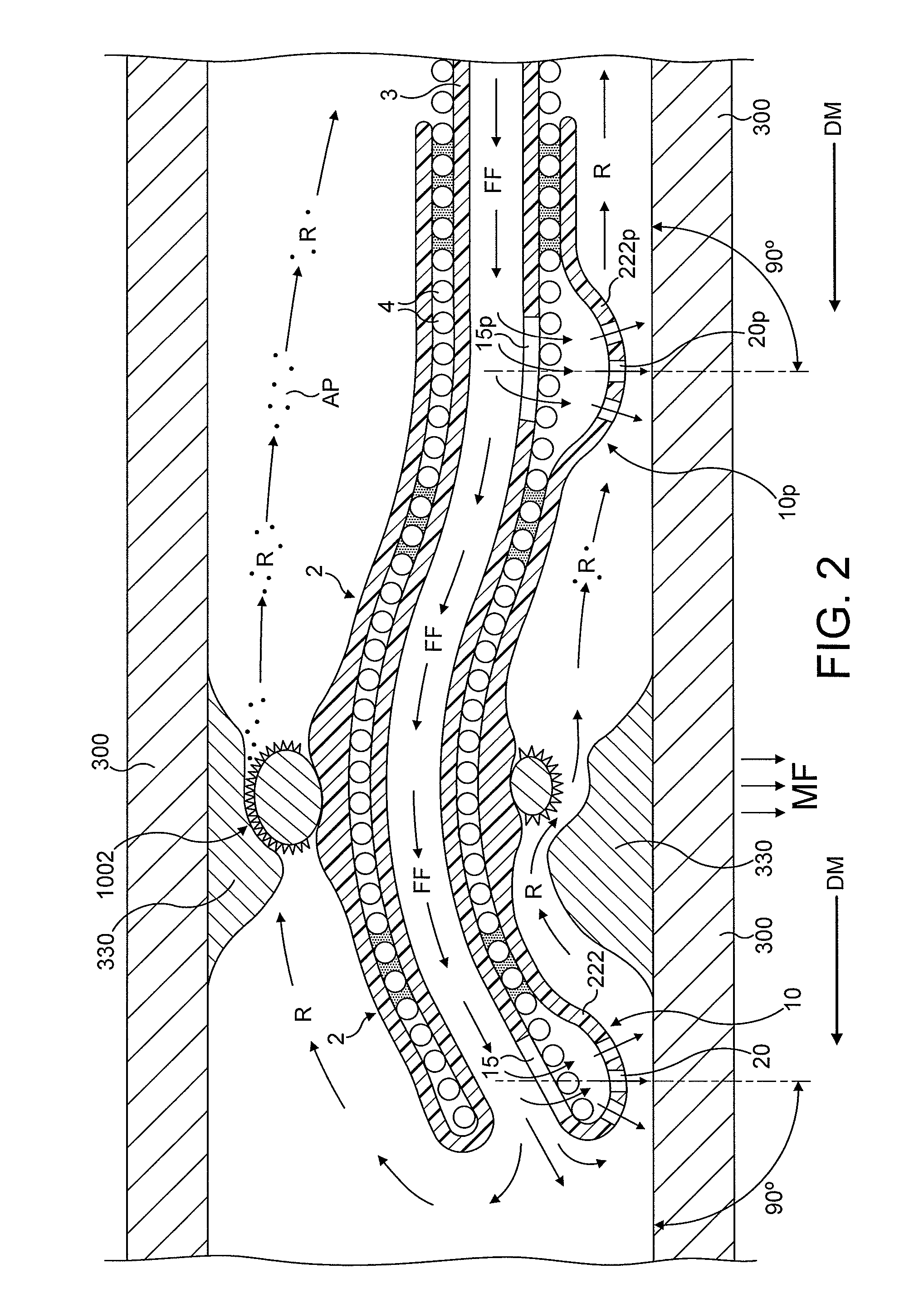 Rotational atherectomy device with fluid inflatable support elements supported by fluid bearings