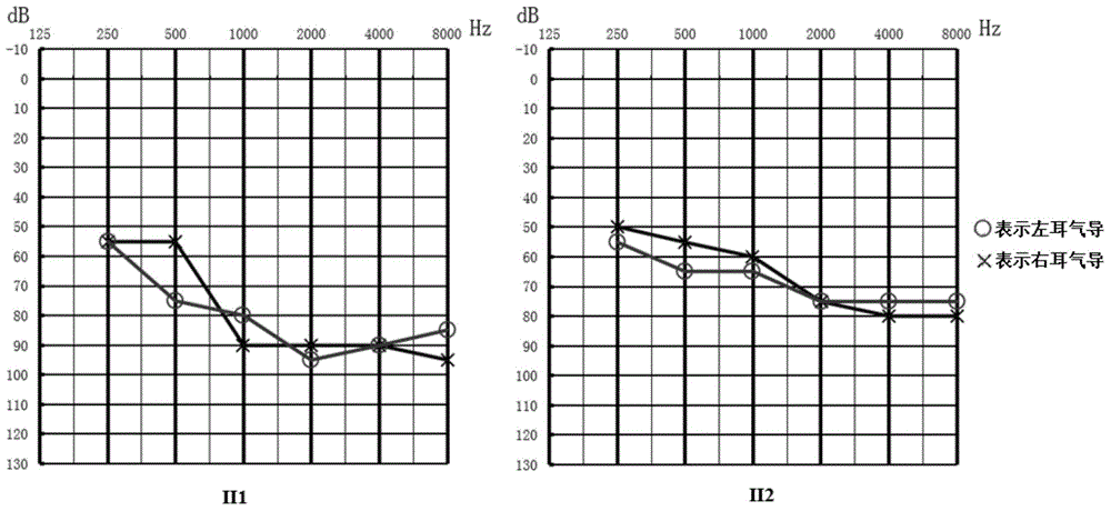 PTPRQ gene mutant and application thereof