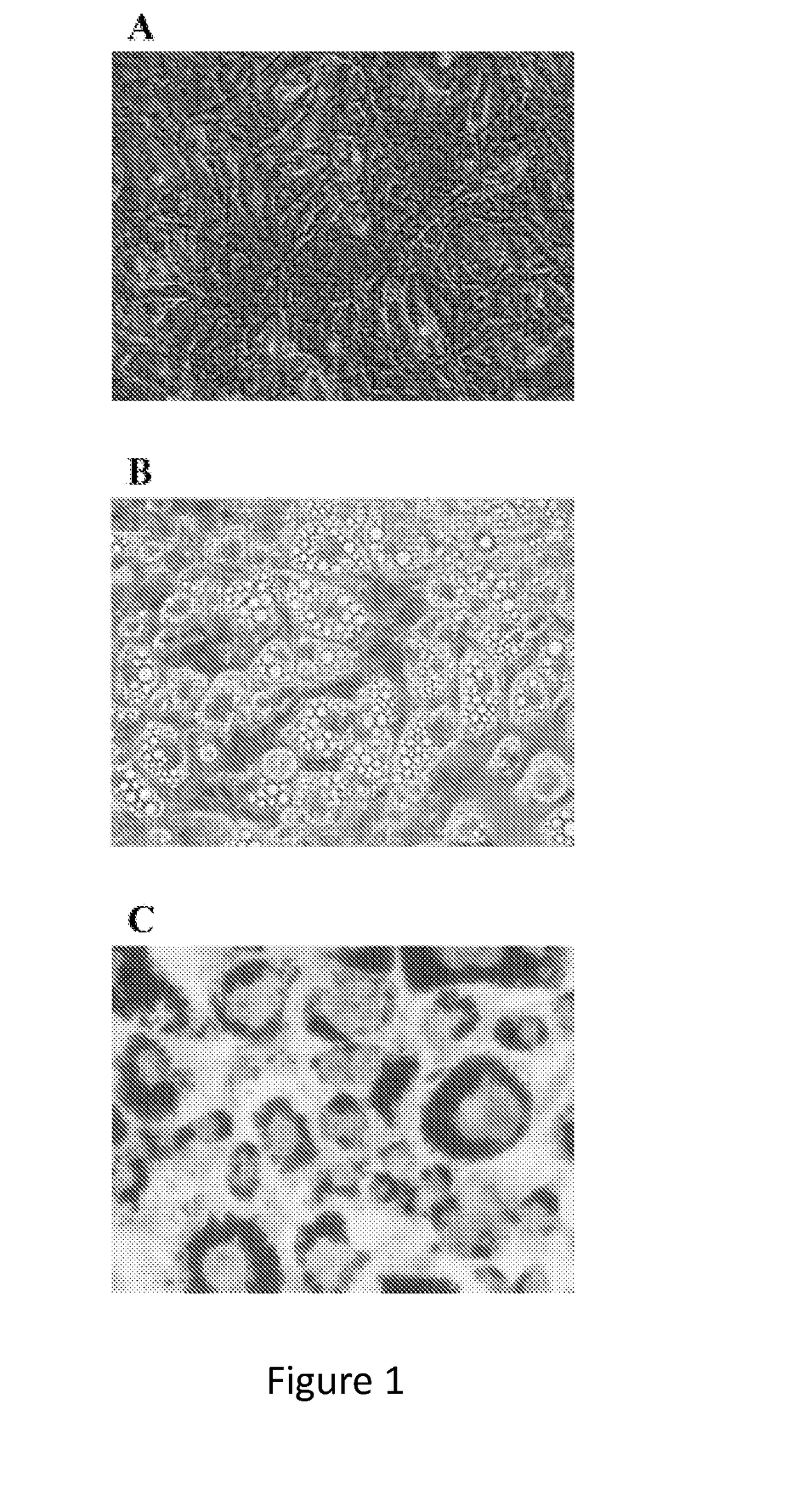 Methods and compositions of bile acids and salts for reduction of fat