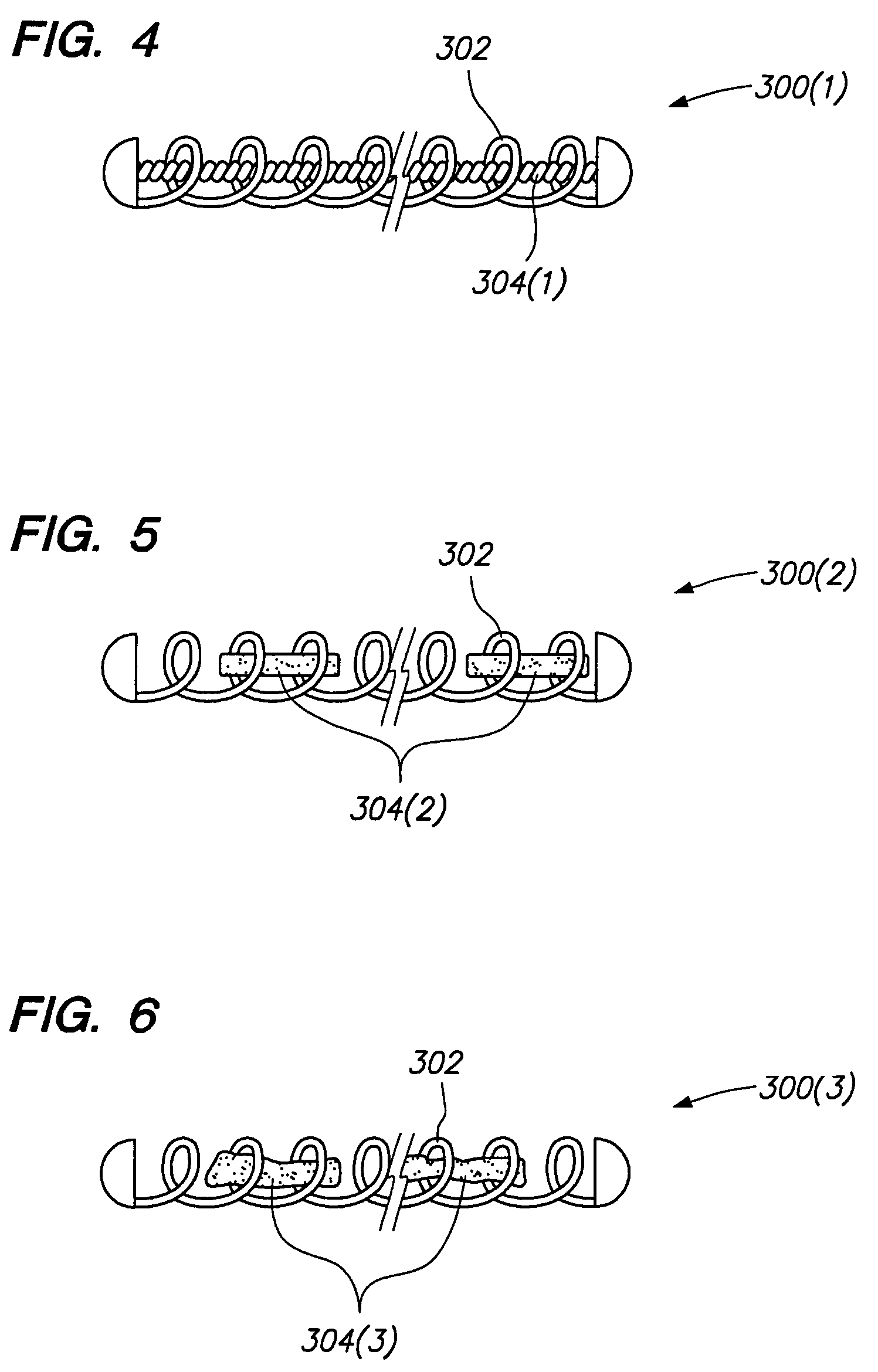 Vaso-occlusive devices with in-situ stiffening elements