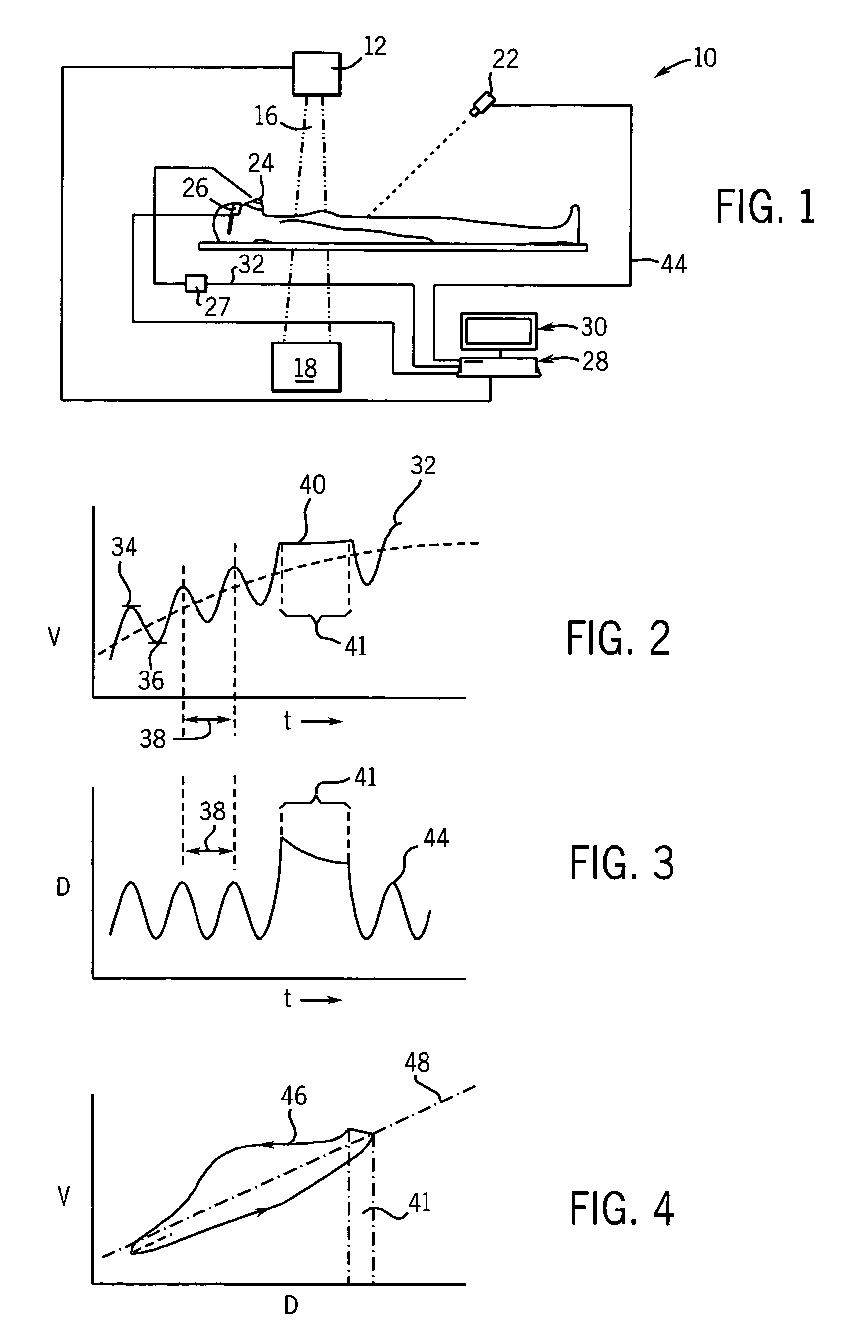 Apparatus and method using synchronized breathing to treat tissue subject to respiratory motion