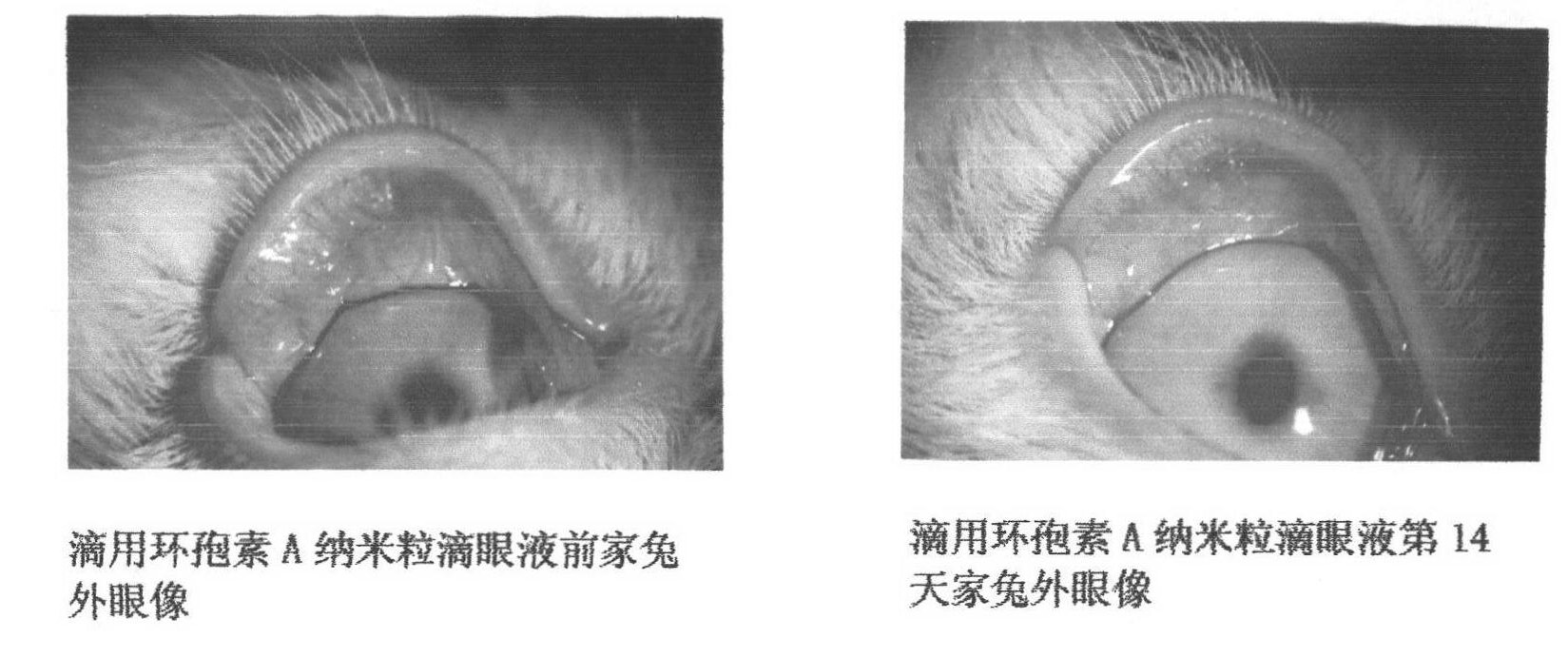 Preparation of cyclosporine A nano-particle eye drop