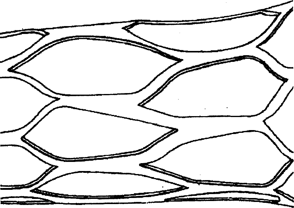 Medicine eluted cardiovascular frame and its preparing process