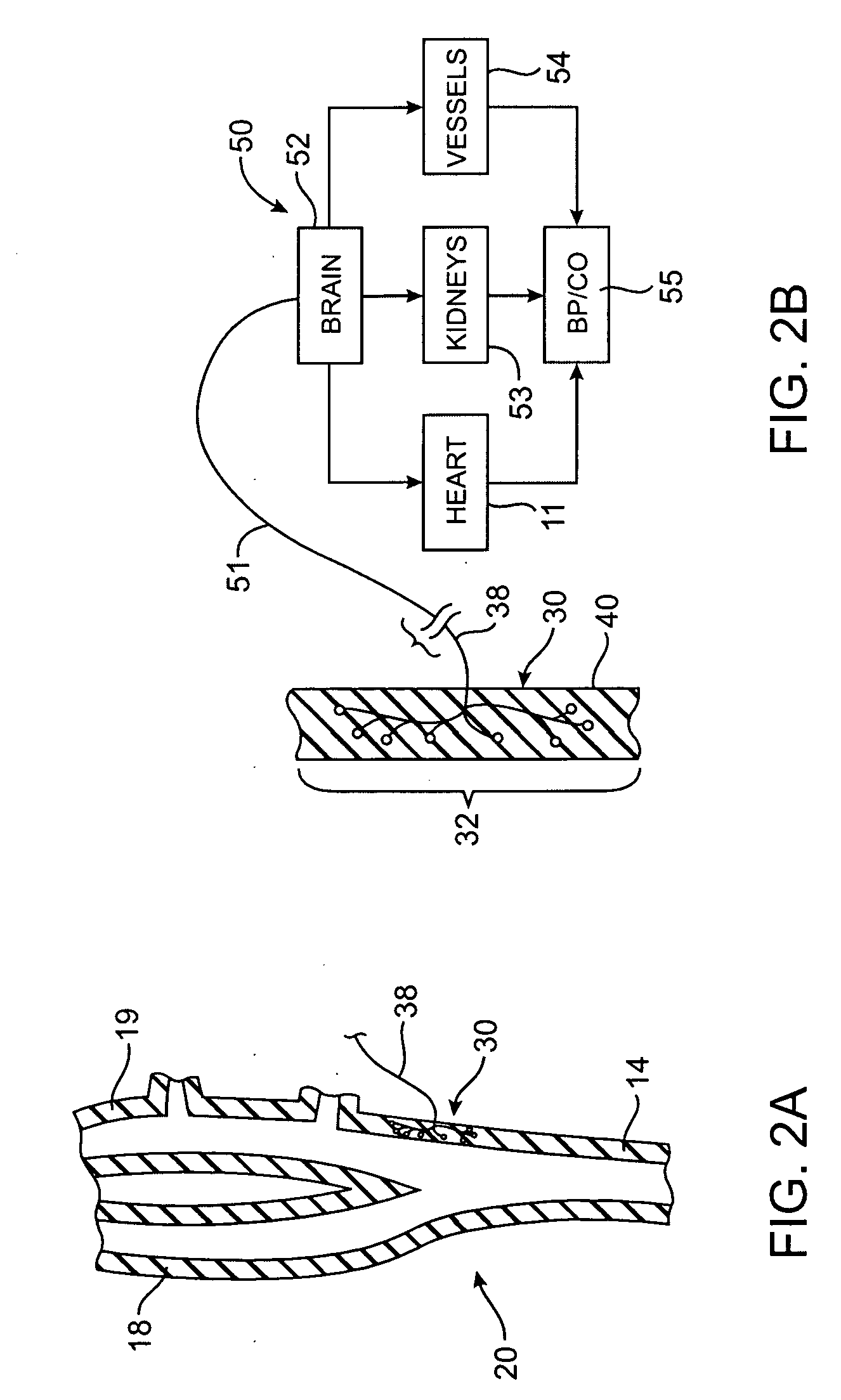 Baroreflex activation therapy with conditional shut off