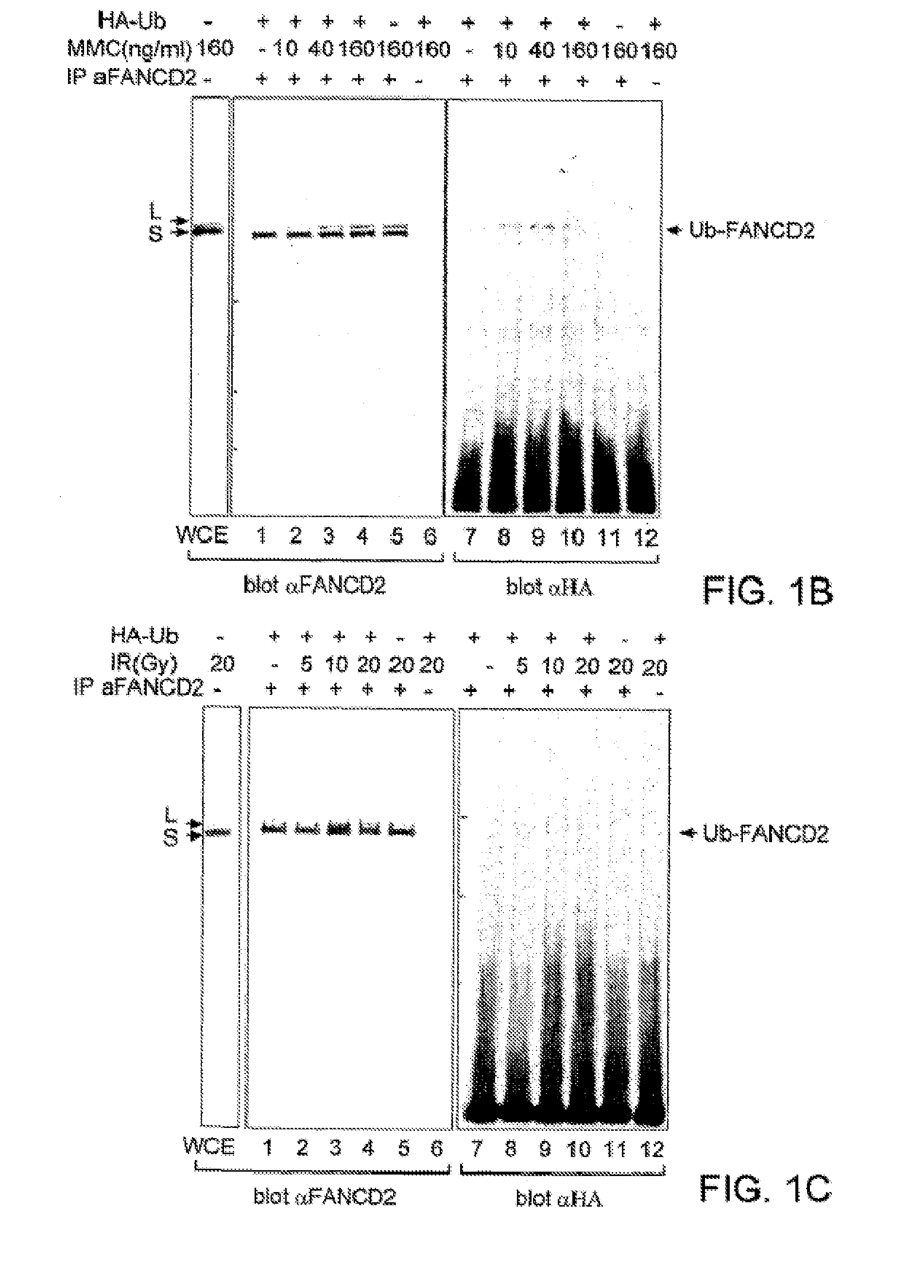 Methods and Compositions for the Diagnosis of Cancer Susceptibilities and Defective DNA Repair Mechanisms and Treatment Thereof