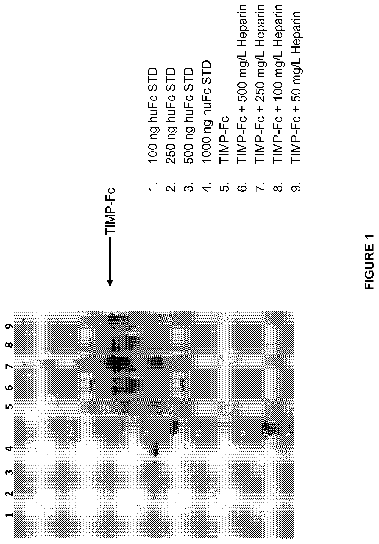 Variants of tissue inhibitor or metalloprotienase type three (TIMP-3), compositions and methods