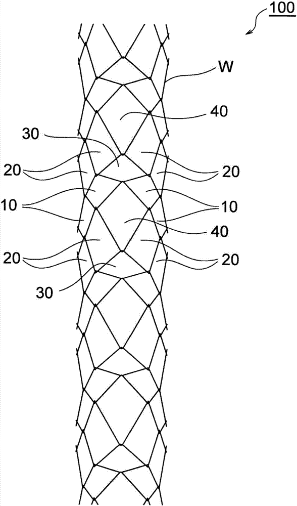 bracket