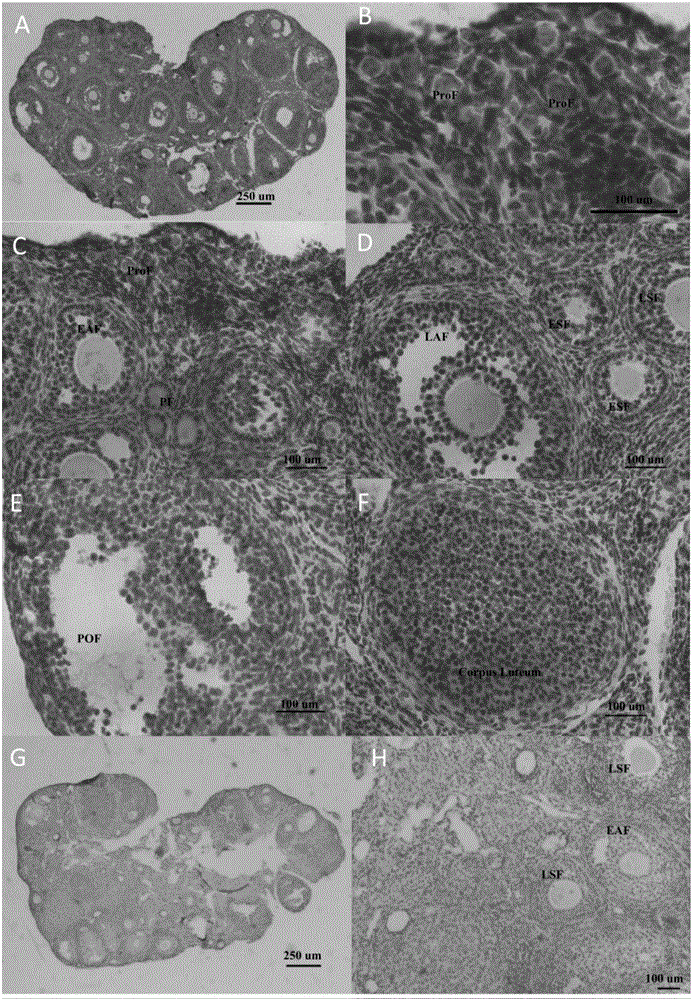 Application of CTRP3 protein (C1qTNF related protein 3)