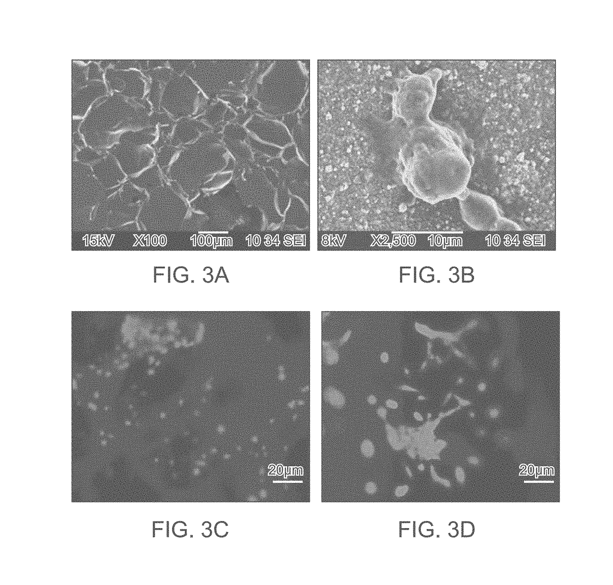 MRI and ct contrast-enabled composite implants for image-guided tissue regeneration and therapy