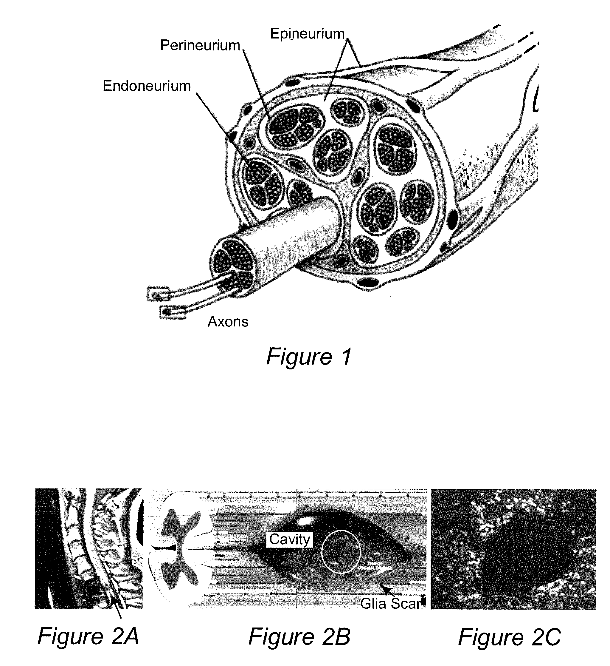 Electrospun nerve guides for nerve regeneration designed to modulate nerve architecture