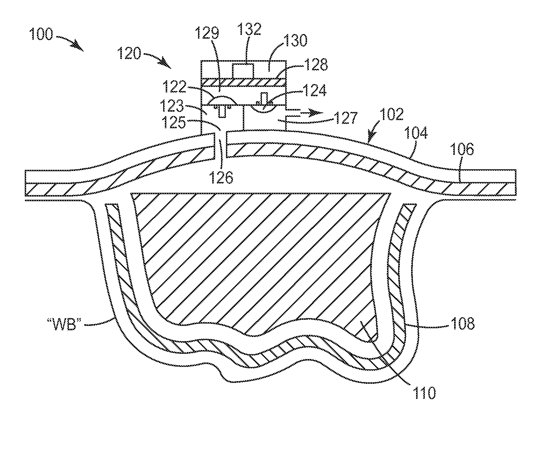 Wound dressing with micropump