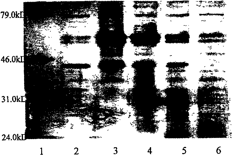 Human tissue factor pathway inhibitory factor mutation gene m2TFPI, recombination carrier and recombination microzyme including the same