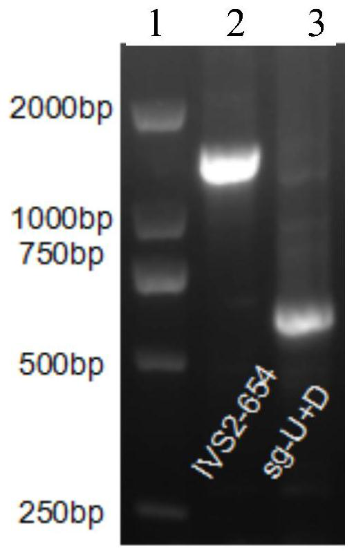 SgRNA and use thereof in repairing abnormal splicing of introns