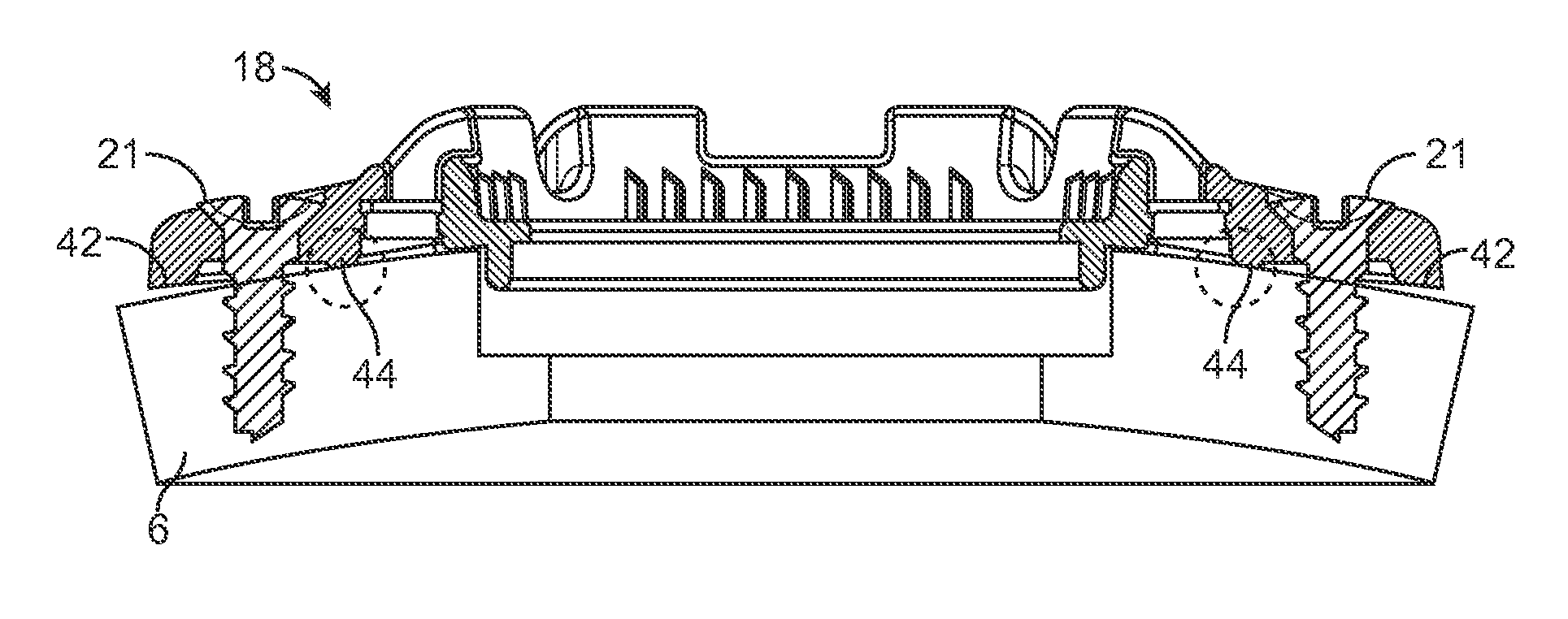 Cranial burr hole plug with Anti-skewing clamping mechanism