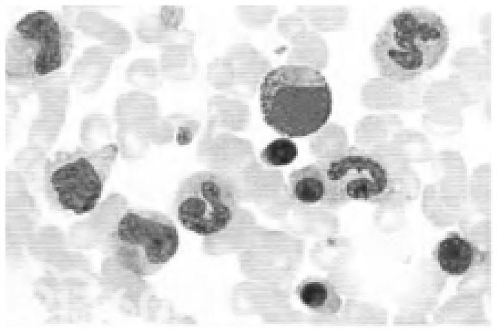 Pathological slice training image set acquisition method, system and device and medium