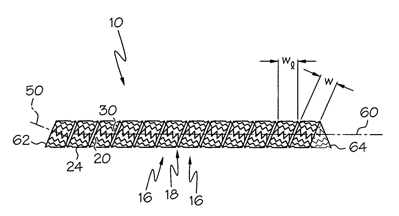 Non-shortening helical stent