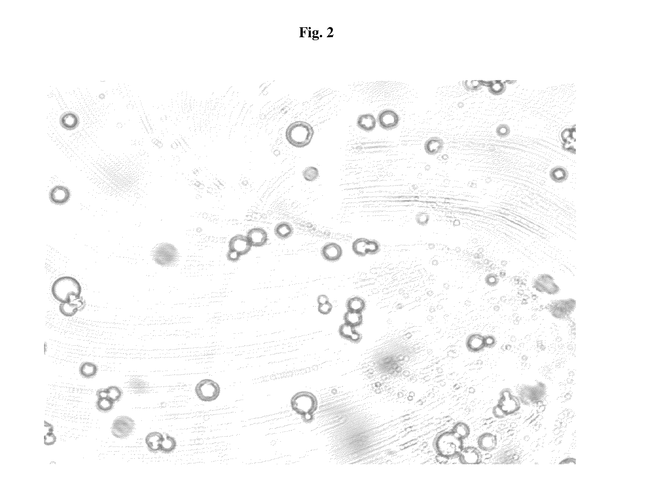 Pharmaceutical Compositions Comprising Phosphate-Binding Polymer