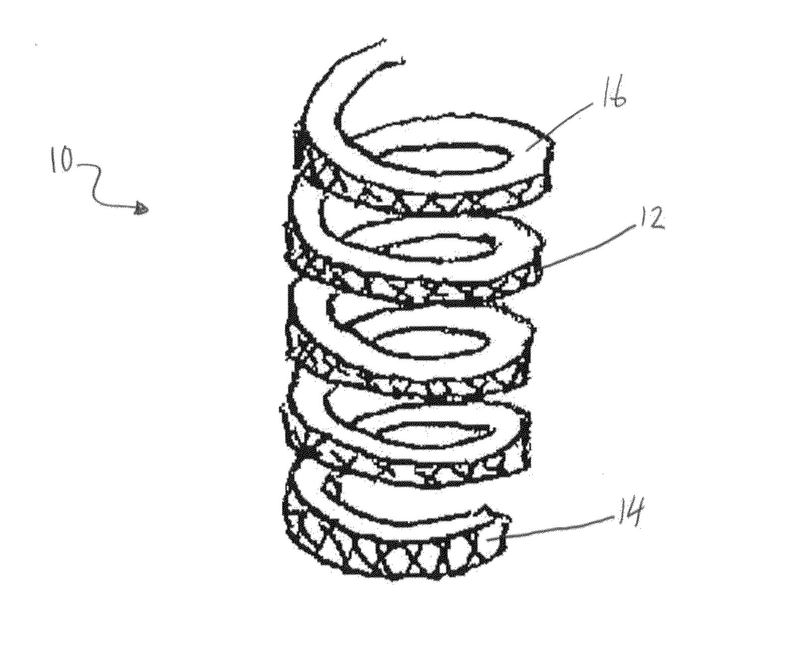 Spring having a core structure