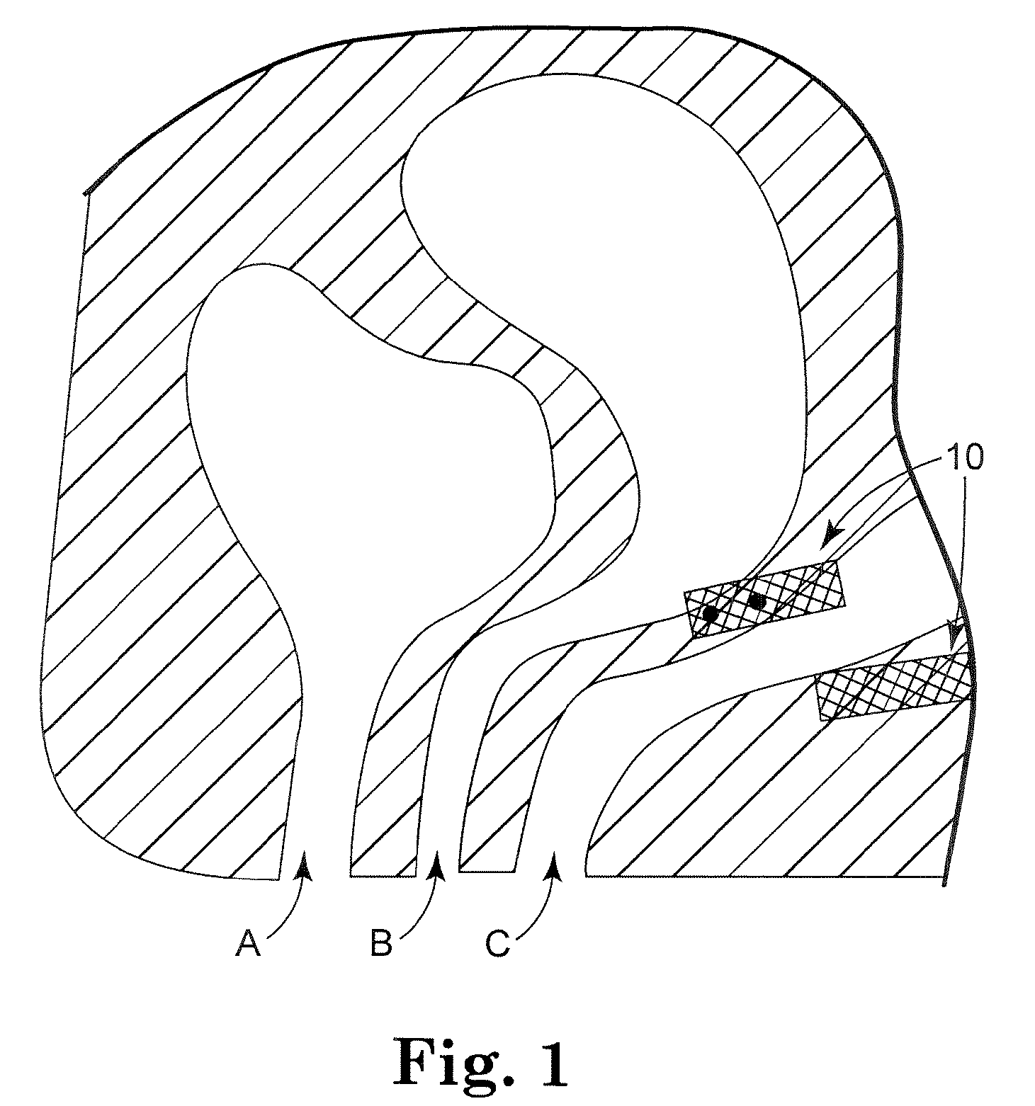 Prolapse and Perineal Repair Concepts