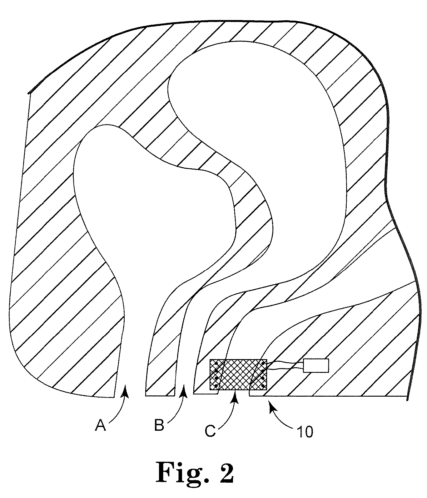 Prolapse and Perineal Repair Concepts