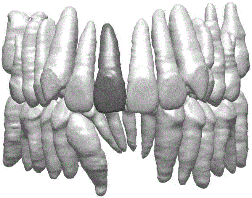 Digital orthodontic tooth arrangement method based on tooth root information and bracket transfer device designing method based on digital orthodontic tooth arrangement method