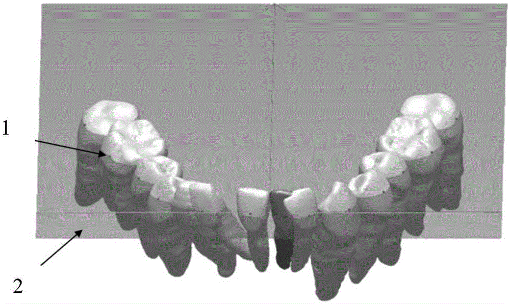 Digital orthodontic tooth arrangement method based on tooth root information and bracket transfer device designing method based on digital orthodontic tooth arrangement method