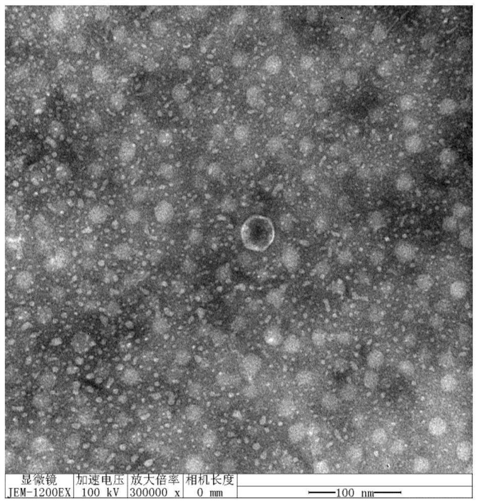 A strong lytic Staphylococcus aureus phage rdp-sr-20001 and its application