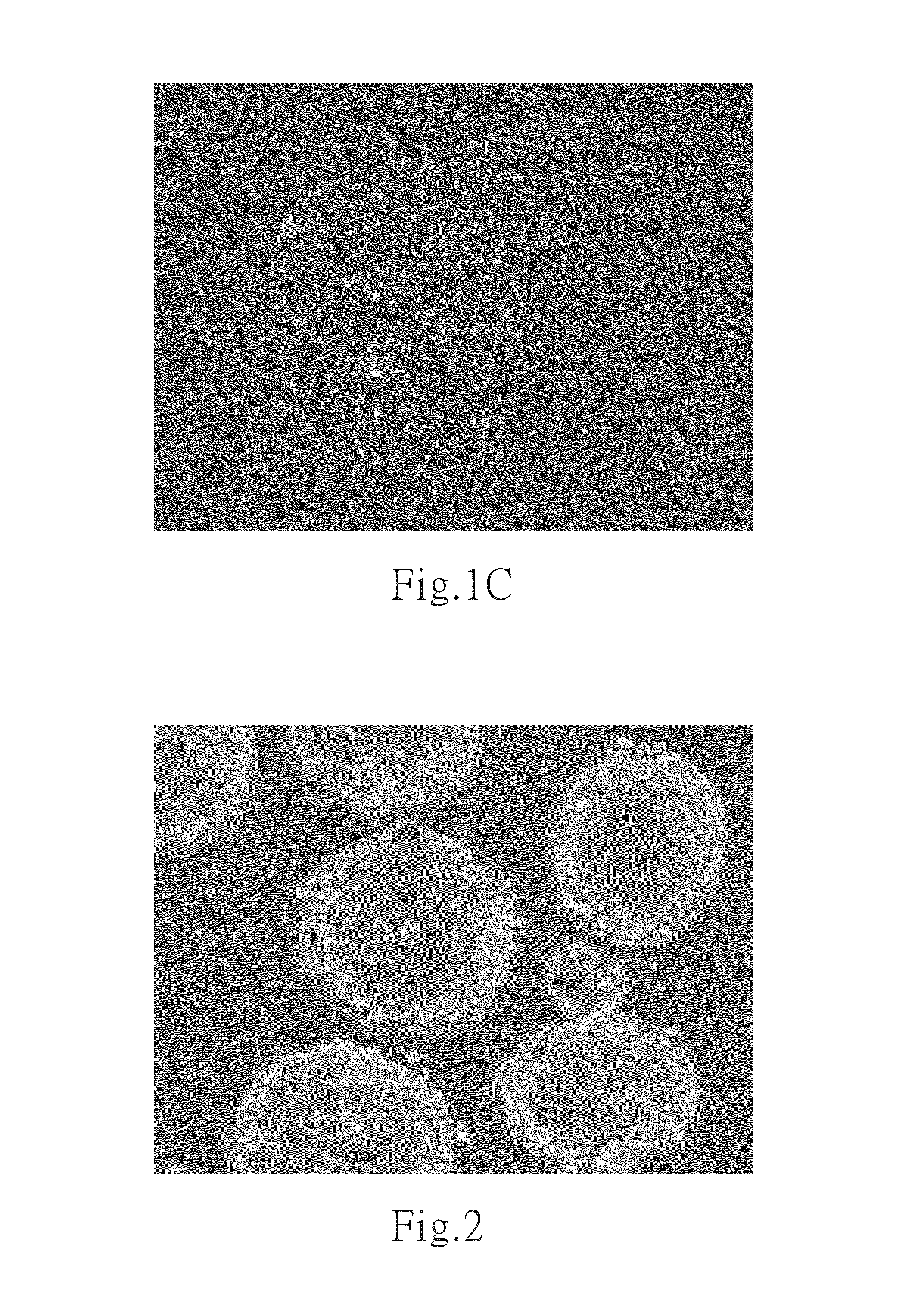 Culture medium and method for inducing differentiation of pluripotent stem cells into neuroepithelial cells