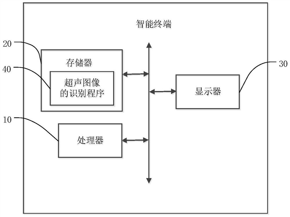 Ultrasonic image recognition method, terminal equipment and storage medium