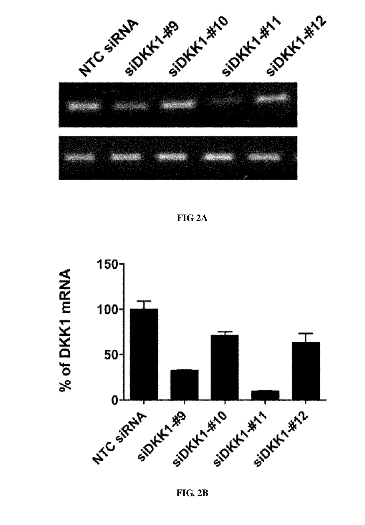 Use of Anti-dkk-1 monoclonal antibodies for treatment of liver cancer