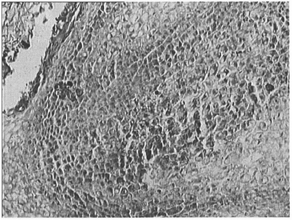 Method for making paraffin slices of Xanthos sorbifolium cutting branches and their calluses