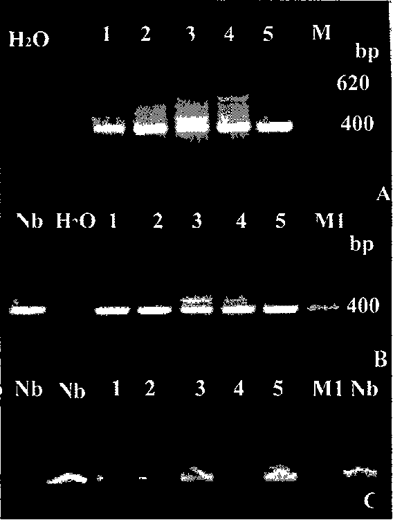 Fast method of extracting microsporidian DNA