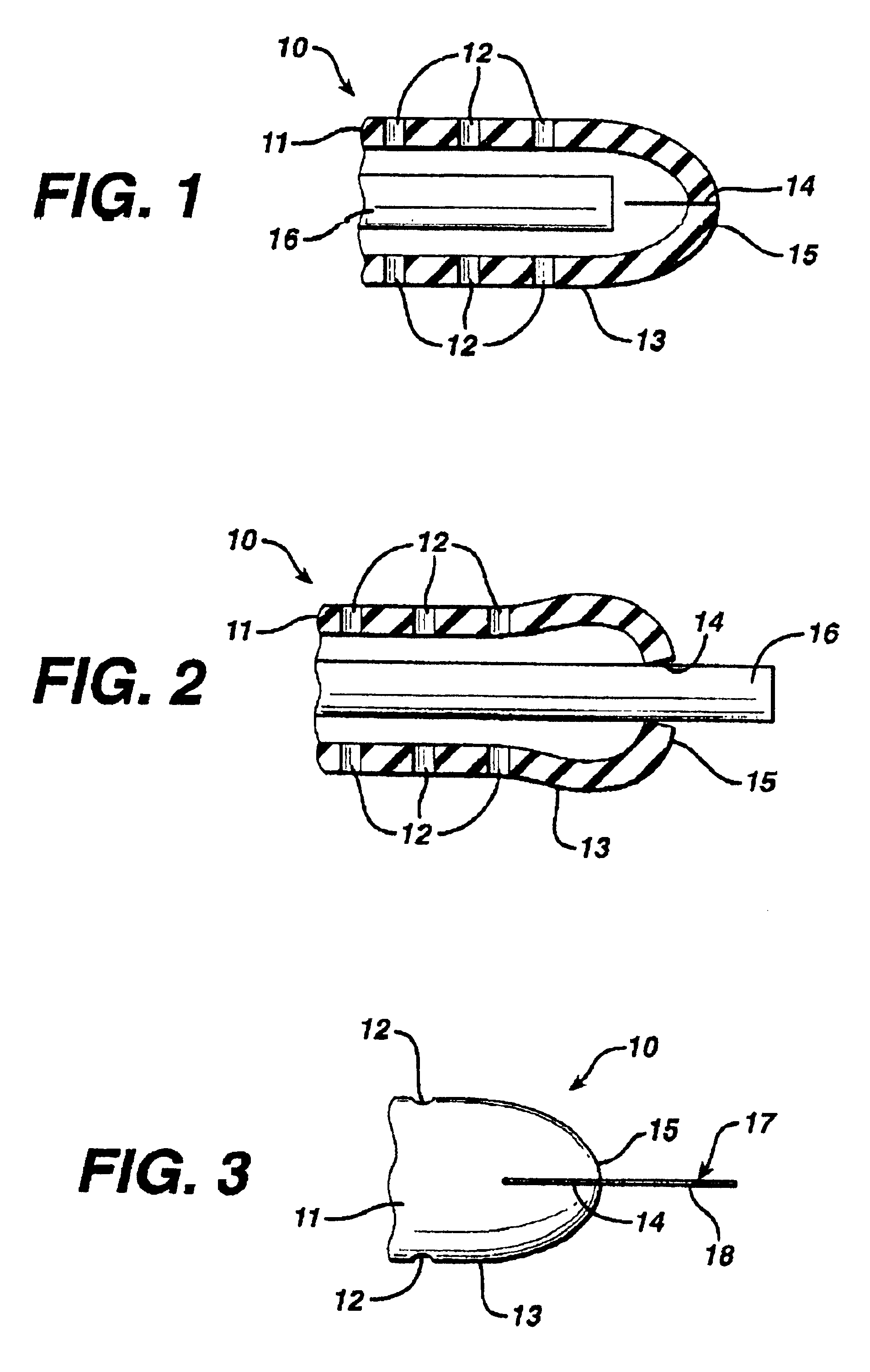 Slit tip ventricular catheter