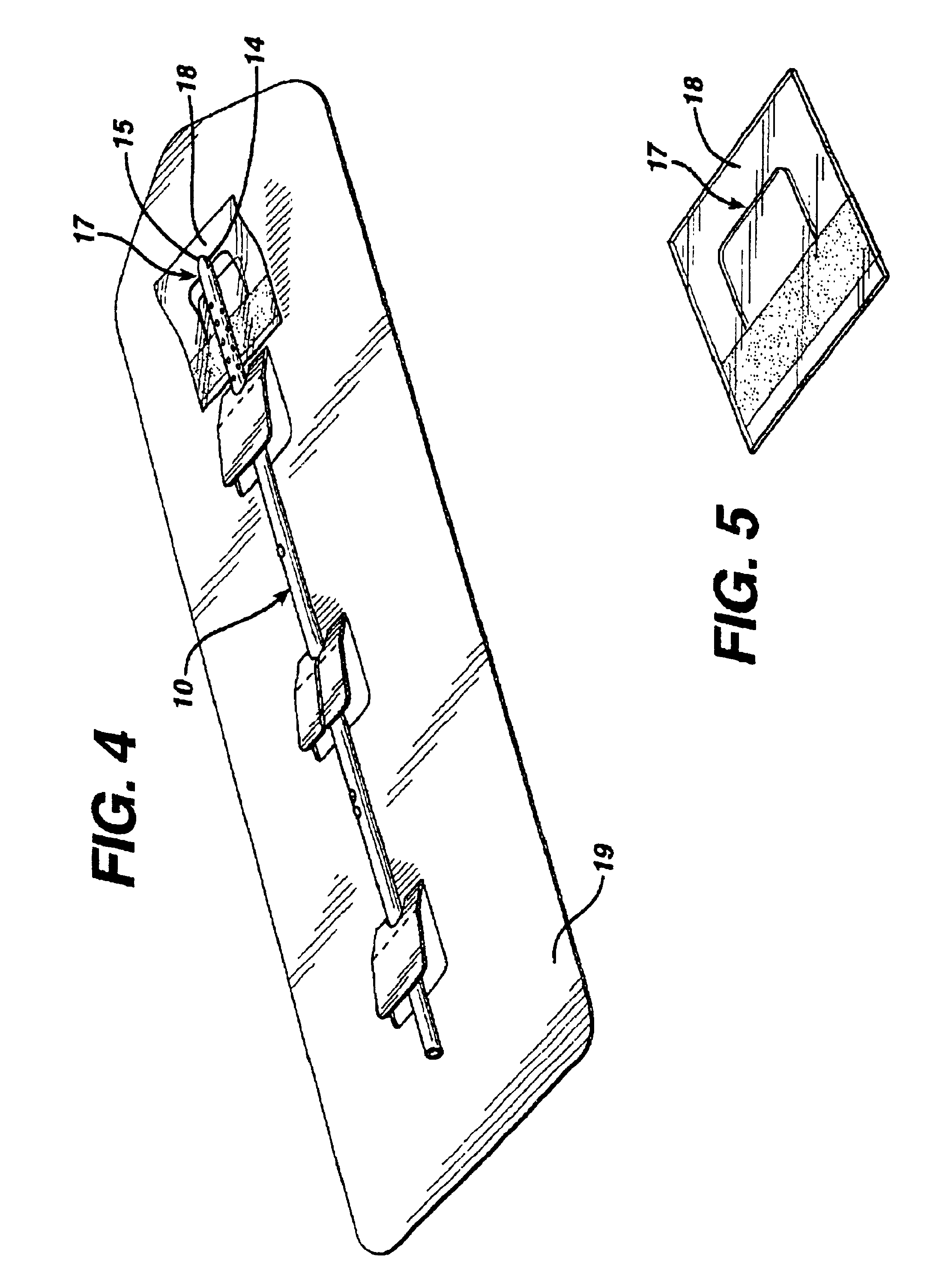 Slit tip ventricular catheter