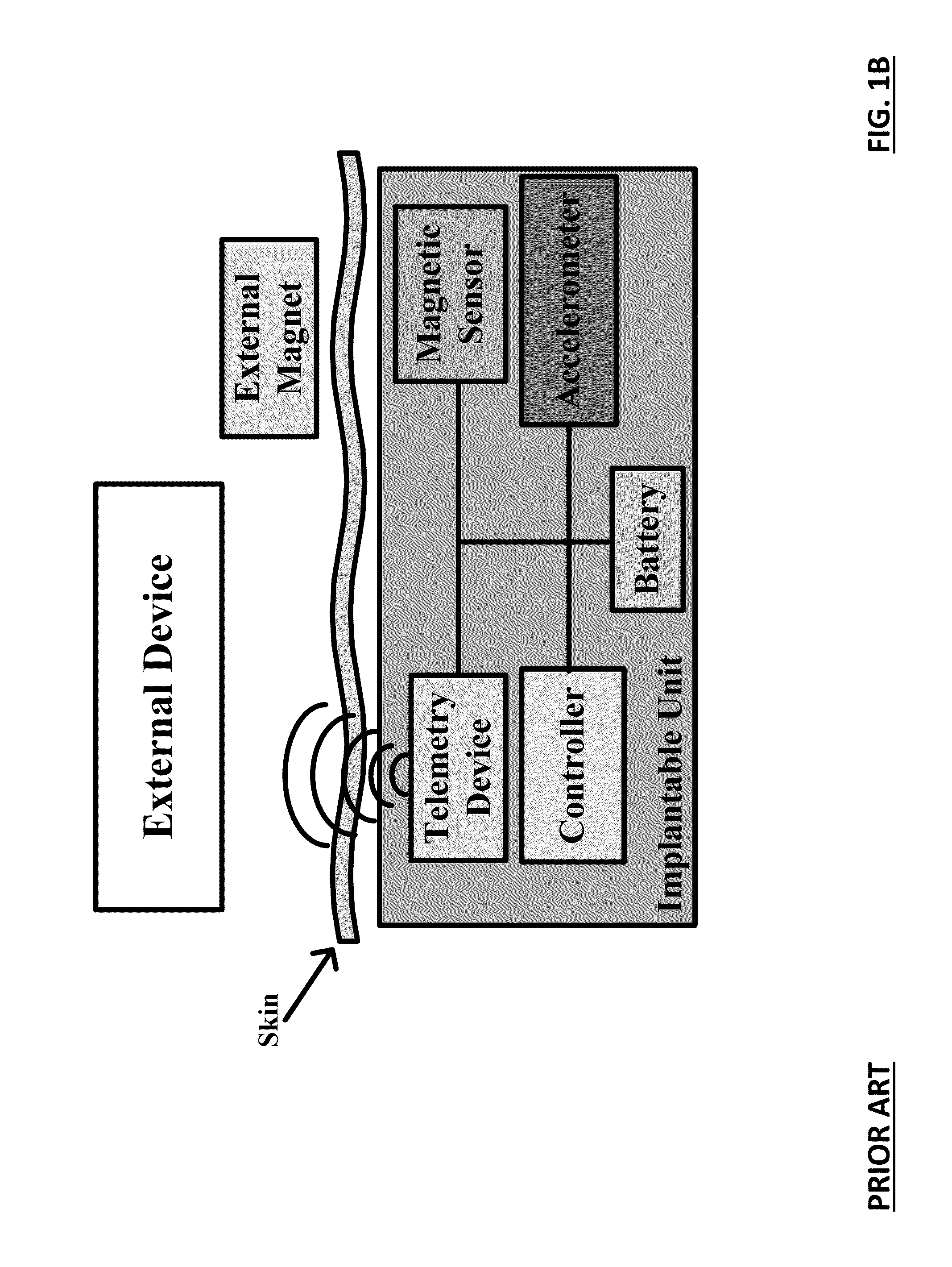 Detection of the spatial location of an implantable biosensing platform and method thereof