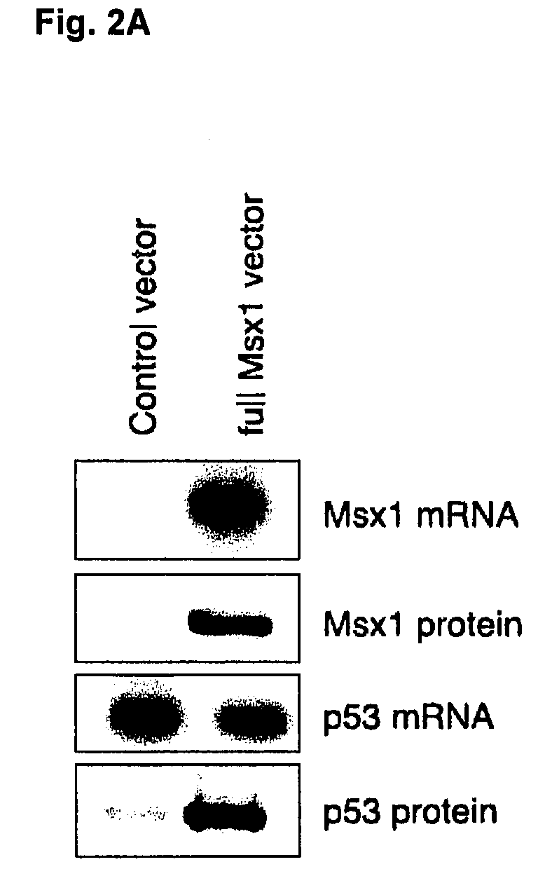 Novel agent for inducing apoptosis comprising msx1 or a gene encoding the same as an active ingredient