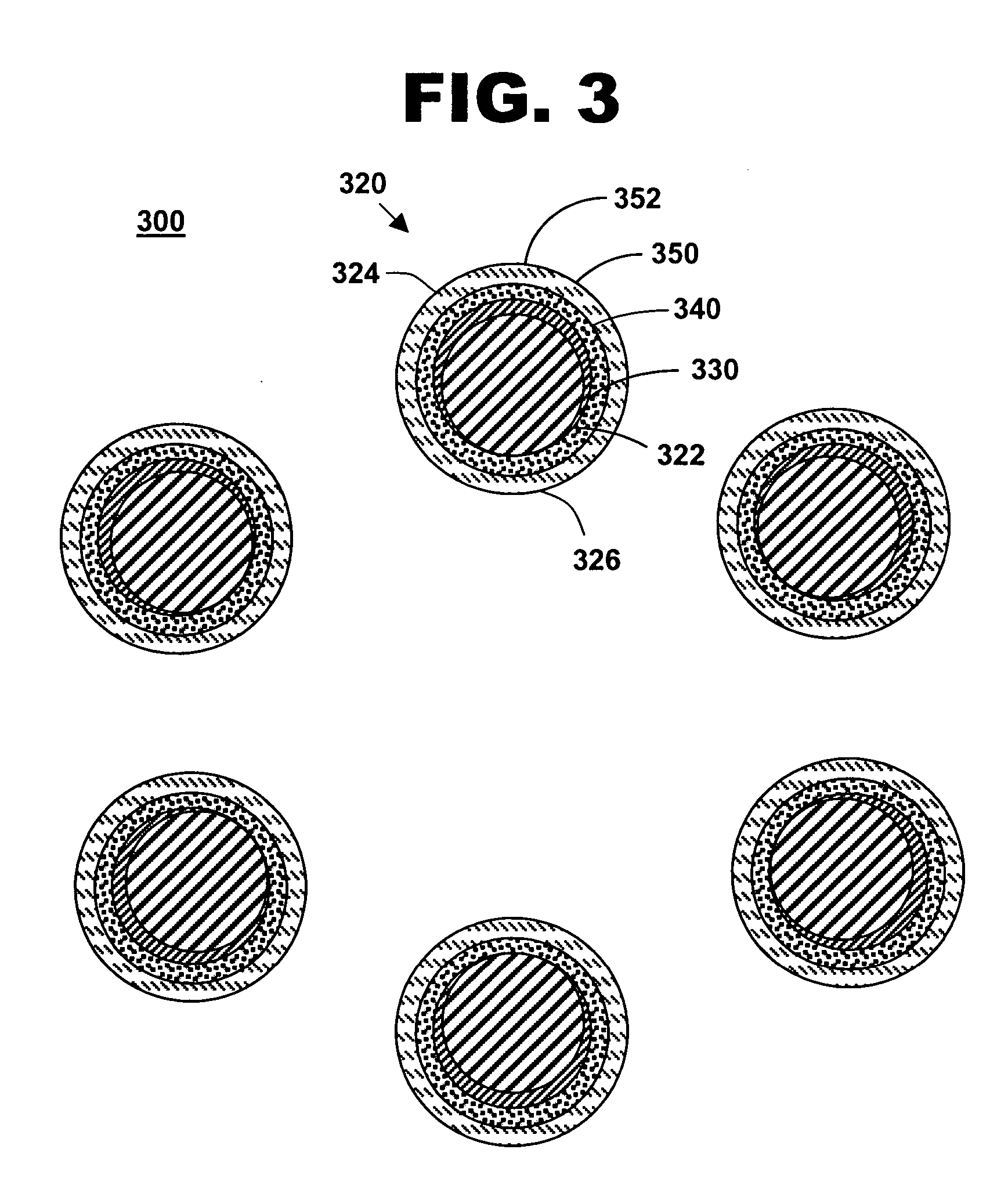 Stent with radiopaque and encapsulant coatings