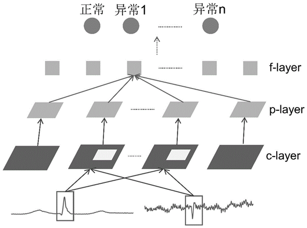 Intelligent arrhythmia diagnosis method based on multiple-lead and convolutional neural network