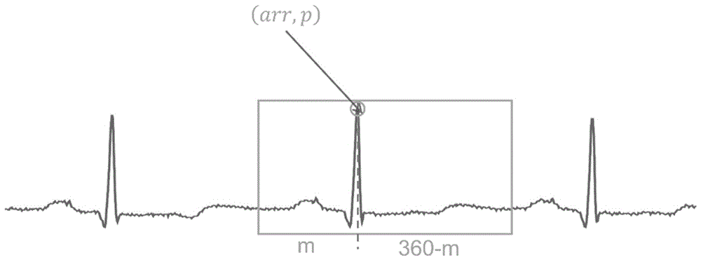 Intelligent arrhythmia diagnosis method based on multiple-lead and convolutional neural network