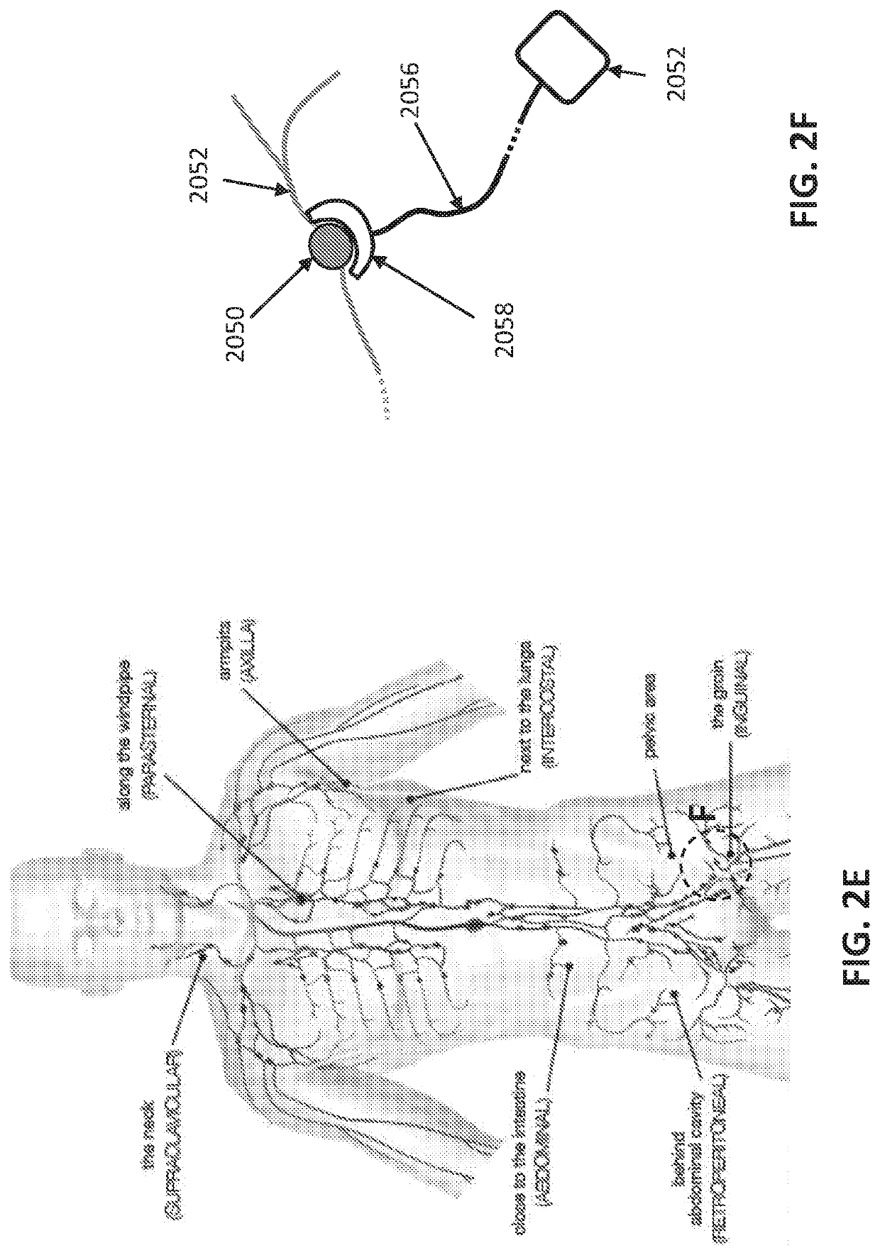 Uvb light therapy for immune disorders