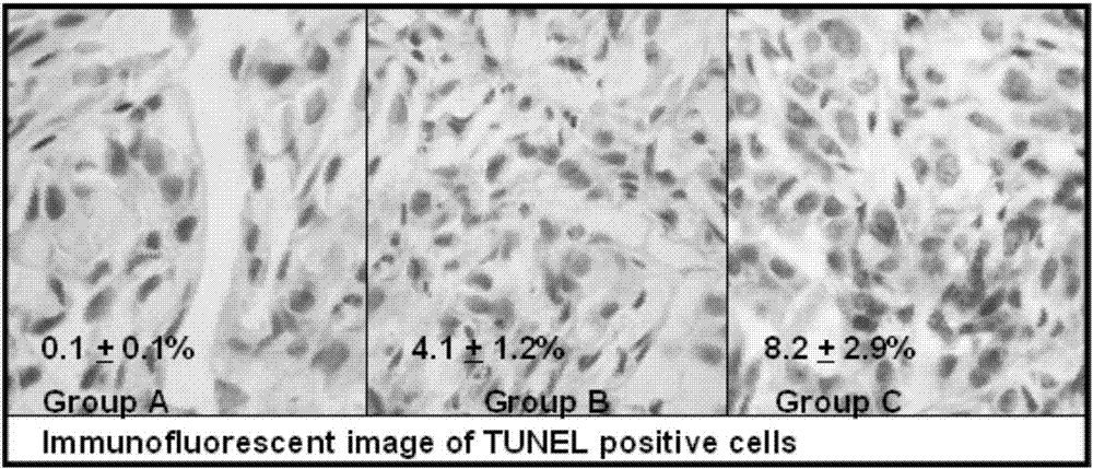 Cyclic adenosine monophosphate boric acid complex, preparation method thereof, anti-tumor drug and neutron capture therapy boron agent