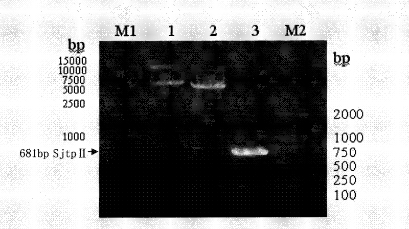 Recombinant expression vector containing Schistosoma japonicum gene and its application