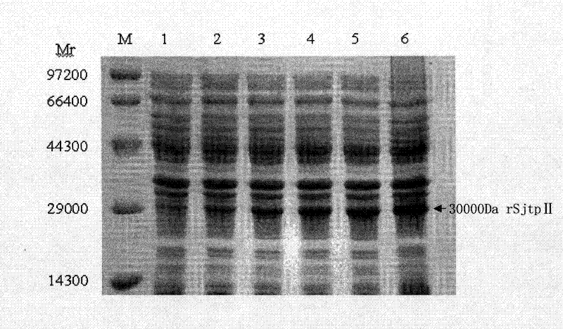 Recombinant expression vector containing Schistosoma japonicum gene and its application