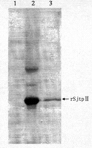 Recombinant expression vector containing Schistosoma japonicum gene and its application