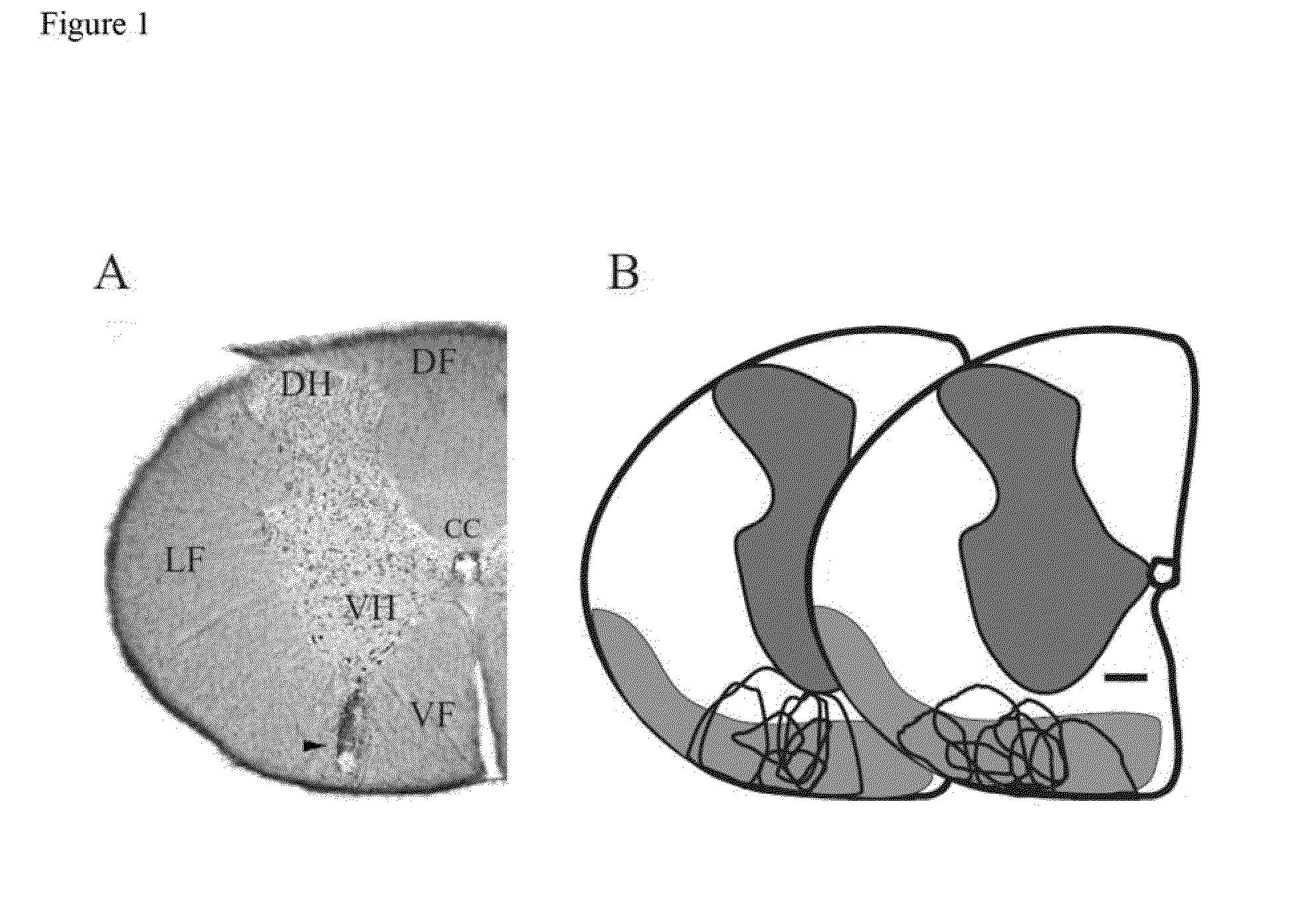 Methods for Treating Central Pain Syndrome and Other Pain Related Pathologies