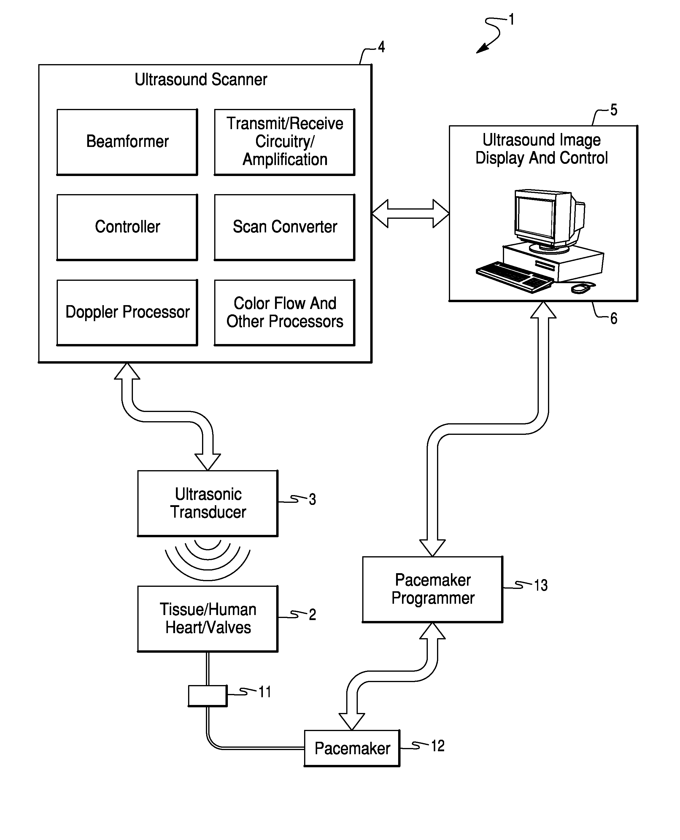 Method and System for Configuration of a Pacemaker and For Placement of Pacemaker Electrodes