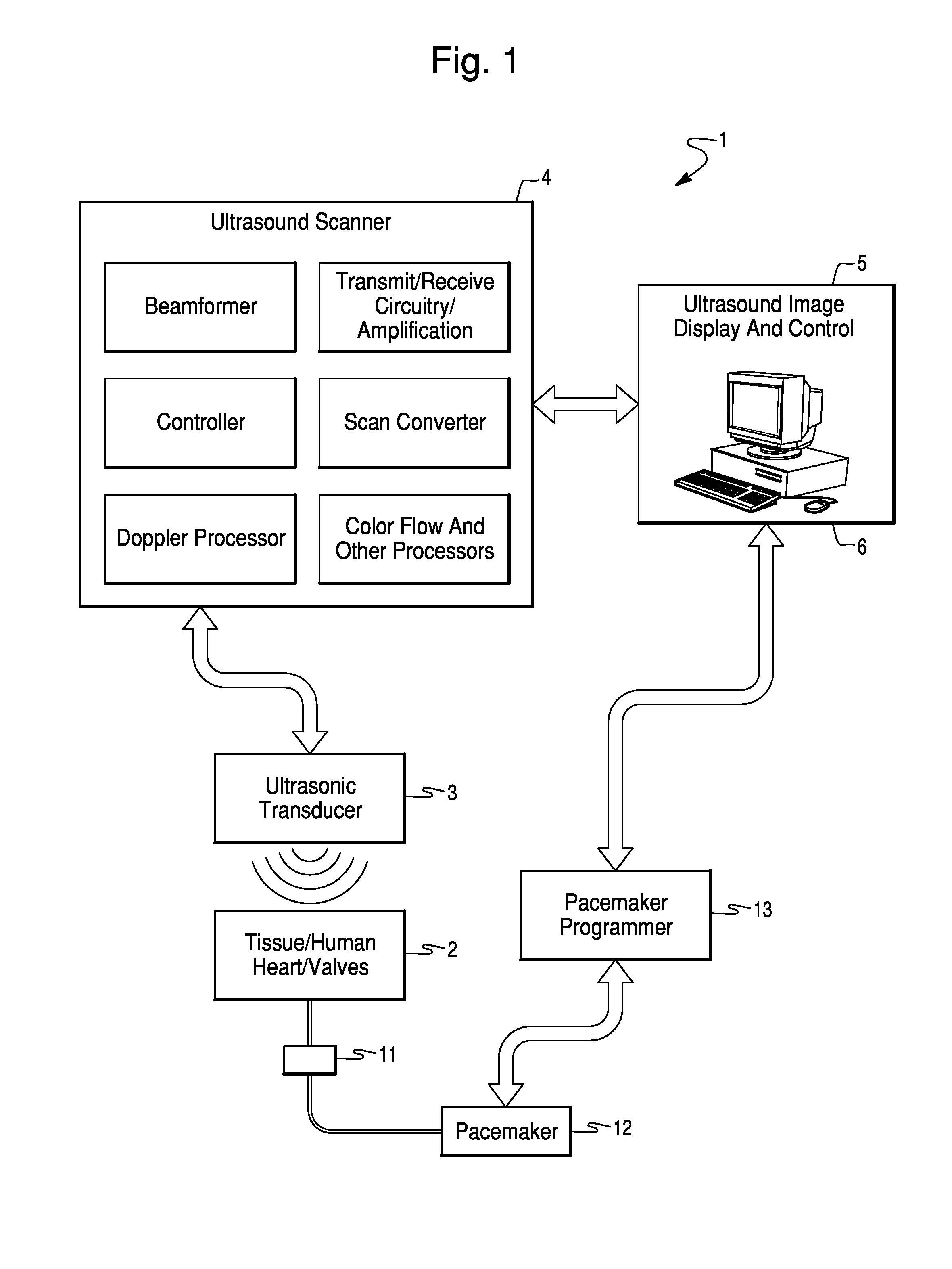 Method and System for Configuration of a Pacemaker and For Placement of Pacemaker Electrodes