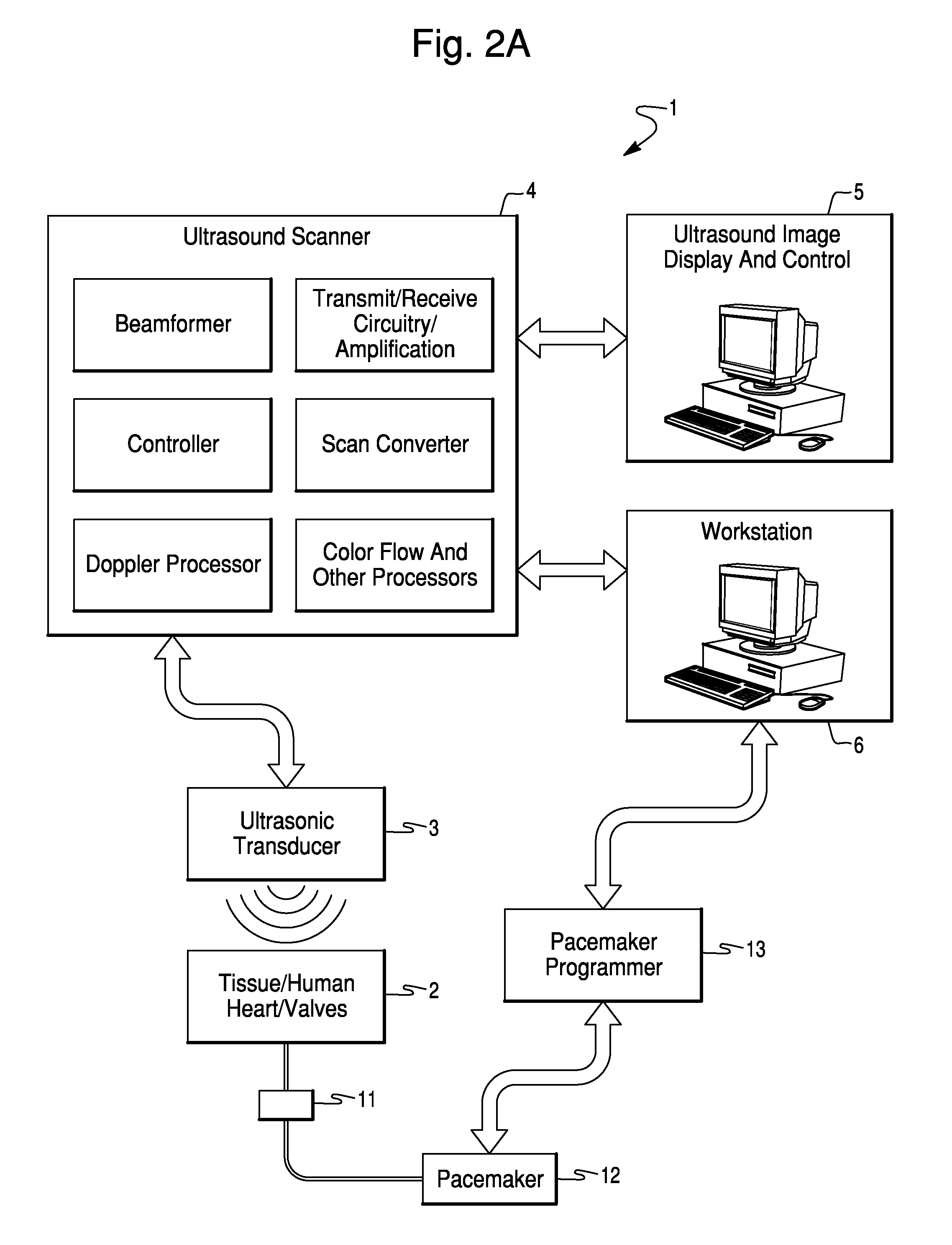 Method and System for Configuration of a Pacemaker and For Placement of Pacemaker Electrodes