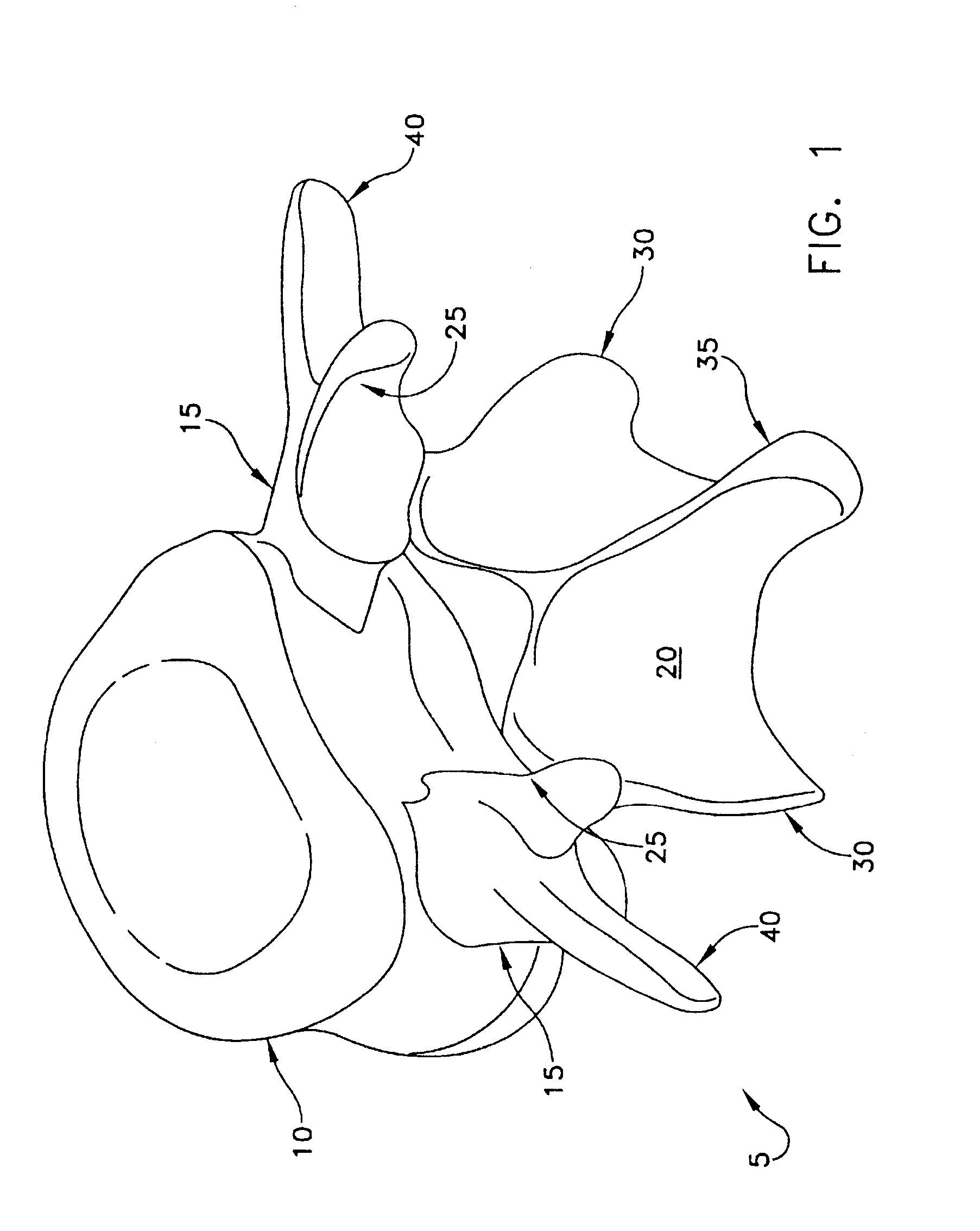 Prosthesis for the replacement of a posterior element of a vertebra