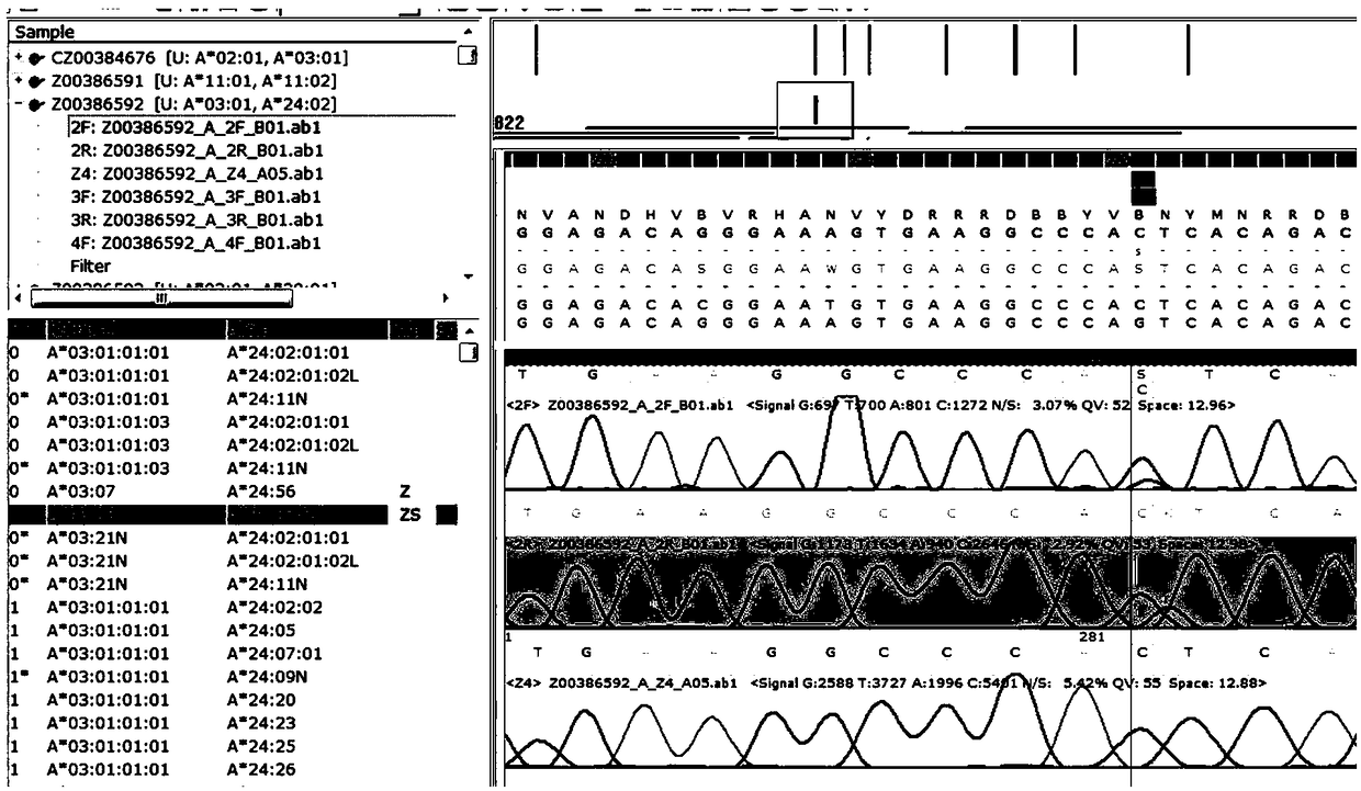 Method of detecting common ambiguous types of HLA (human leukocyte antigen) typing locus A